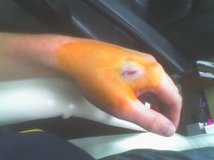 RFID_hand_2.jpg