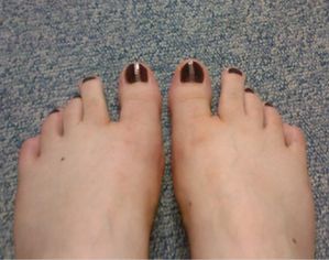 pieds-OPI-black-chutney-cherry.jpg