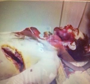 Tamerlan--the-death-body.JPG