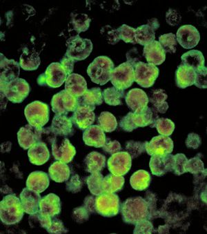 des-amibes-naegleria-fowleri-a-l-attaque-de-tissus-cerebrau.jpg
