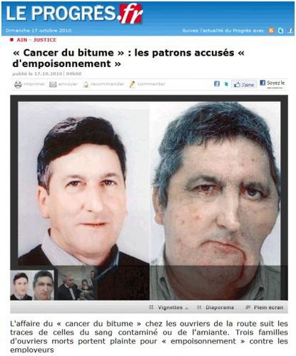 Cancer Bitume