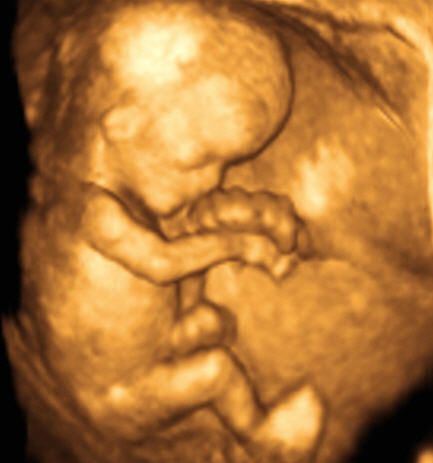 L Echographie La Science Pour Tous