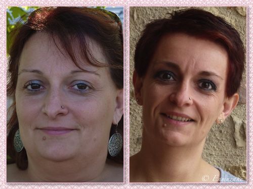 après visage