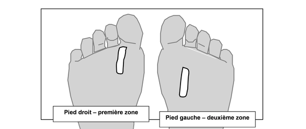 Zone-reflexe-de-l-oesophage-et-du-larynx.png