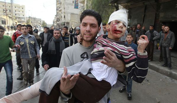 sem13fevf-Z3-enfant-blesse-en-Syrie-Alep.jpg