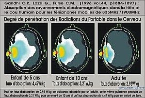 DAS-radiation-telephone-copie-2.JPG