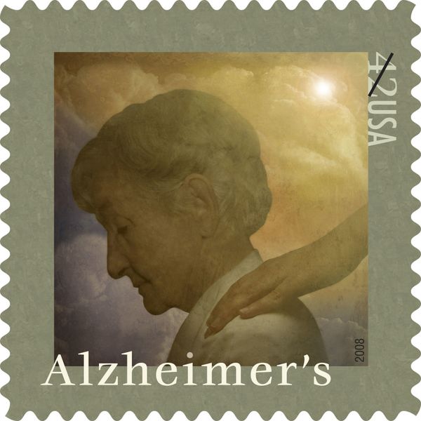 alzheimers-pr-Milev.jpg